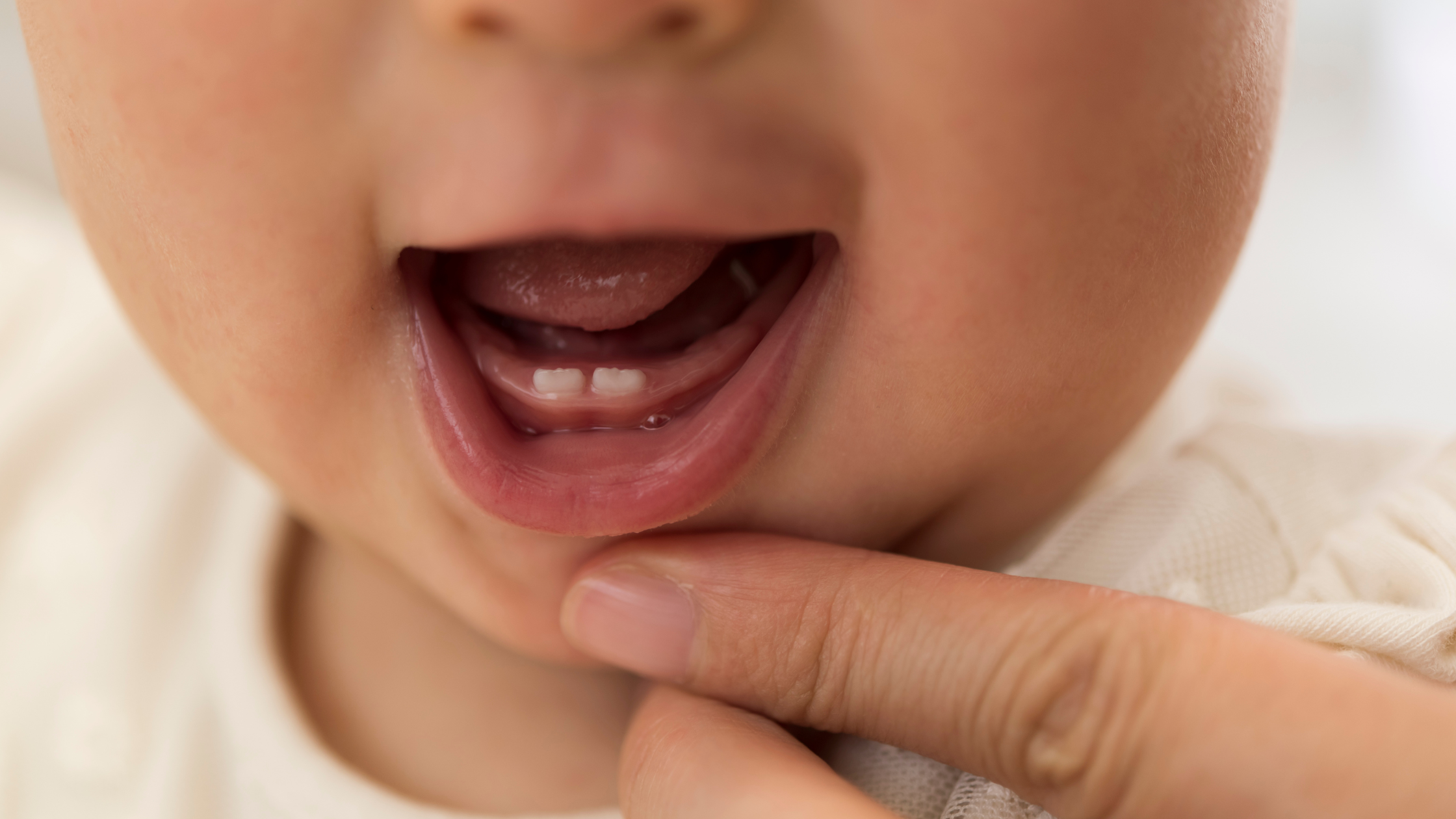Baby’s First Dental Visit: When to Go, What to Expect, and How to Prepare