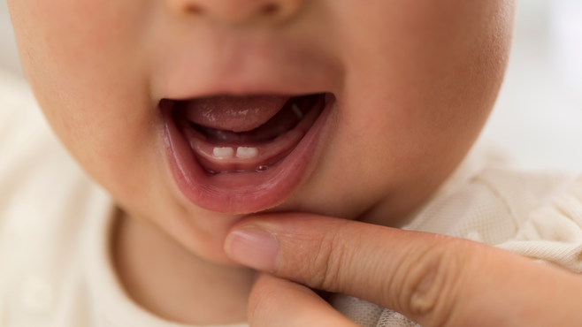 Baby’s First Dental Visit: When to Go, What to Expect, and How to Prepare